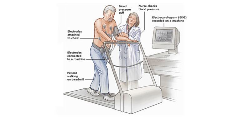 Stress Test & Treadmill Test