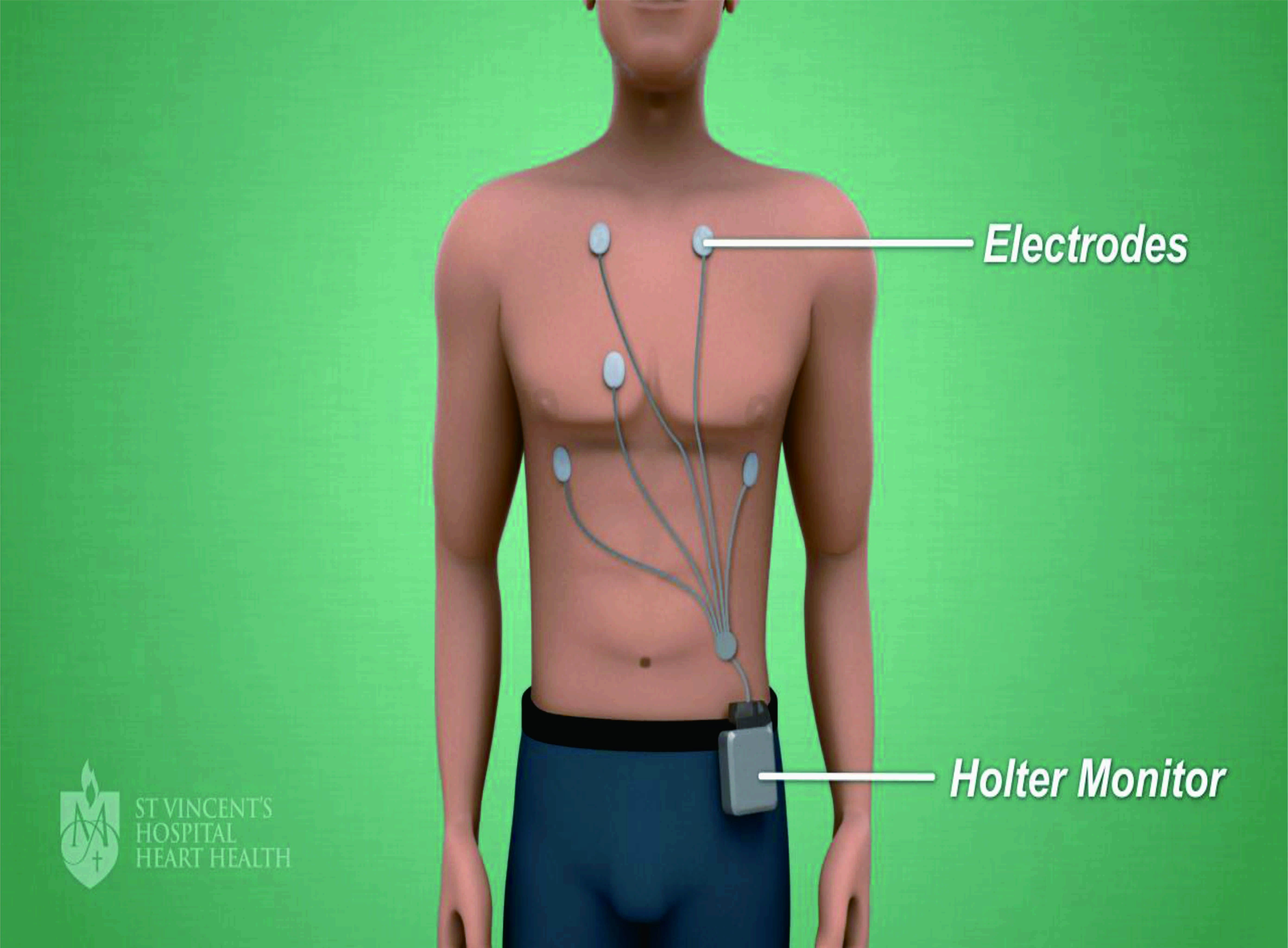 Holter ECG Electrode Testing